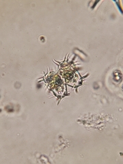 Xanthidium antilopaeum