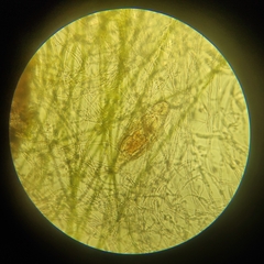 Bdelloidea