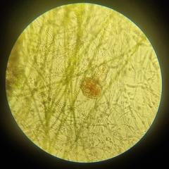 Bdelloidea