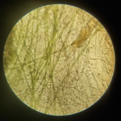 Bdelloidea