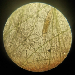 Bdelloidea