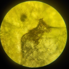 Bdelloidea