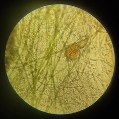 Bdelloidea