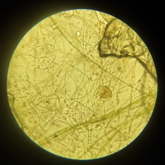 Bdelloidea