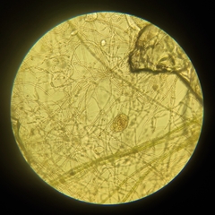 Bdelloidea