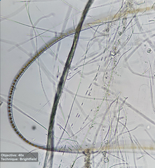 Fragilaria