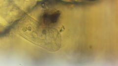 Sessilida