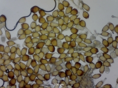 Uromyces viciae-fabae