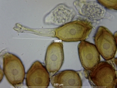Uromyces viciae-fabae