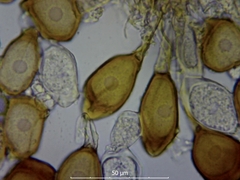 Uromyces viciae-fabae