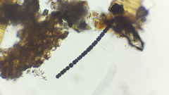 Dolichospermum