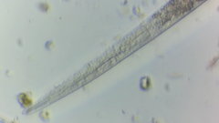 Nematoda