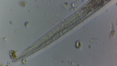 Nematoda