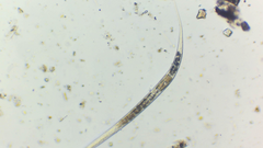 Nematoda