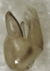 Cryptoneossa triangula