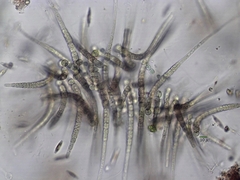 Gloeotrichia echinulata