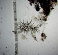 Gloeotrichia echinulata