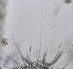 Gloeotrichia echinulata