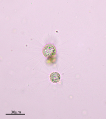 Heliozoa