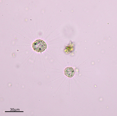 Heliozoa