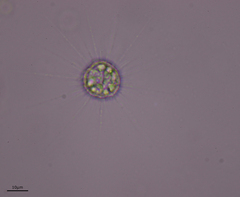 Heliozoa