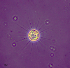 Heliozoa