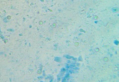 Leucocoprinus flavescens