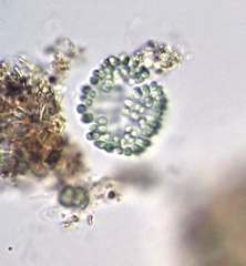 Coelosphaerium aerugineum