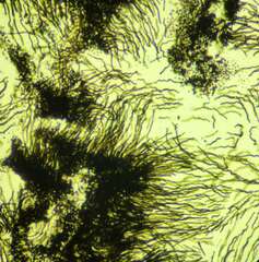 Aureobasidium pullulans