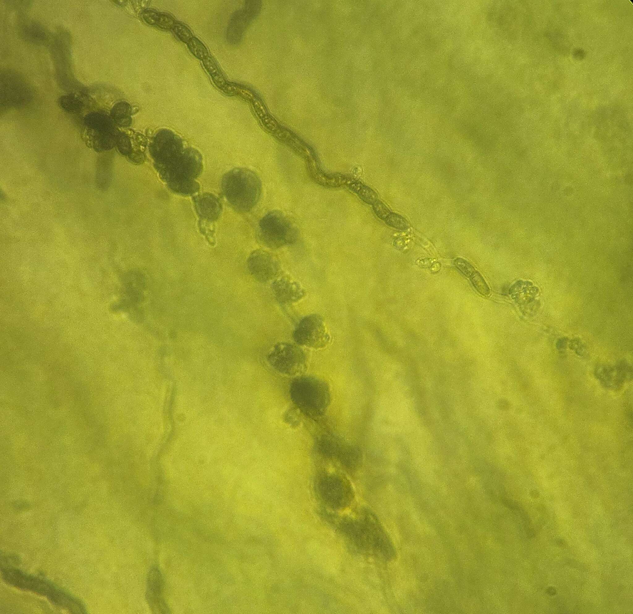 Aureobasidium pullulans (de Bary & Löwenthal) G.Arnaud