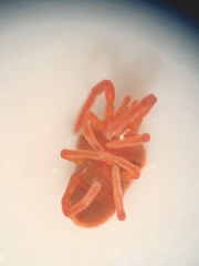 Trombidioidea