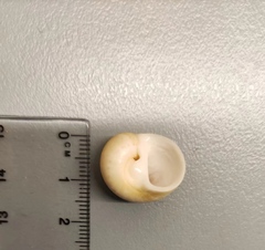 Naticarius orientalis