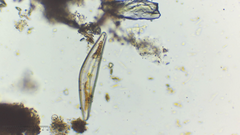 Cymbella