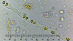 Binuclearia tectorum