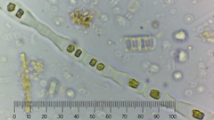 Binuclearia tectorum