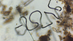 Dolichospermum
