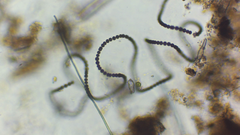 Dolichospermum