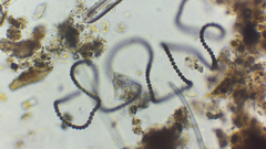 Dolichospermum