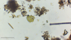 Pseudopediastrum boryanum longicorne