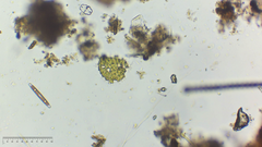Pseudopediastrum boryanum longicorne