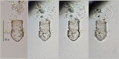 Codonella cratera