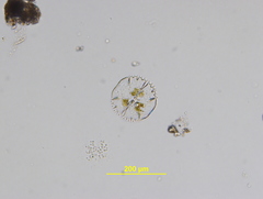 Micrasterias truncata