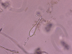 Phyllactinia fraxini
