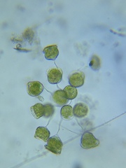 Pseudovorticella