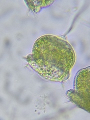Pseudovorticella
