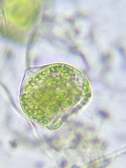 Pseudovorticella