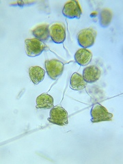 Pseudovorticella