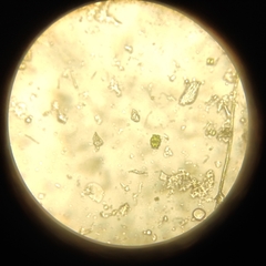 Euastrum denticulatum