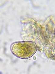 Ostracoda