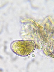 Ostracoda